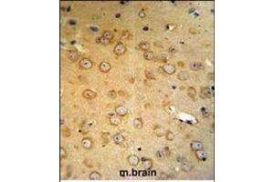 Immunohistochemistry (Paraffin-embedded Sections) (IHC (p)) image for anti-Von Hippel-Lindau Tumor Suppressor, E3 Ubiquitin Protein Ligase (VHL) (AA 181-210), (C-Term) antibody (ABIN390463)