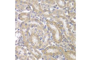 Immunohistochemistry (IHC) image for anti-Keratin 17 (KRT17) (AA 133-432) antibody (ABIN3023124) (KRT17 抗体  (AA 133-432))