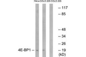 Western blot analysis of extracts from HeLa/COLO205 cells, treated with EGF 200ng/ml 5', using 4E-BP1 (Ab-45) Antibody. (eIF4EBP1 抗体  (AA 13-62))