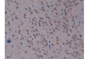 Immunohistochemistry (IHC) image for anti-Carboxypeptidase B2 (Plasma) (CPB2) (AA 113-422) antibody (ABIN7438442)