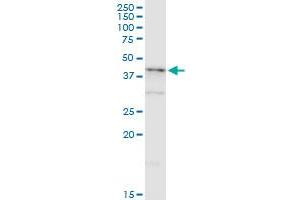 NDRG2 monoclonal antibody (M03), clone 6A5. (NDRG2 抗体  (AA 1-96))