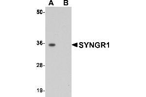 Western Blotting (WB) image for anti-Synaptogyrin 1 (SYNGR1) (Middle Region) antibody (ABIN1031113) (Synaptogyrin 1 抗体  (Middle Region))
