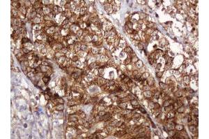 Image no. 8 for anti-B and T Lymphocyte Associated (BTLA) antibody (ABIN1496983)