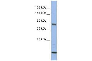 MAP3K11 antibody used at 1 ug/ml to detect target protein. (MAP3K11 抗体  (Middle Region))