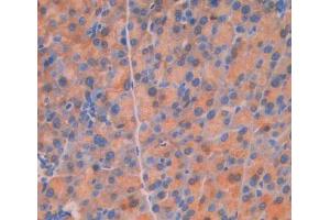 Used in DAB staining on fromalin fixed paraffin- embedded Kidney tissue (UPP1 抗体  (AA 1-277))