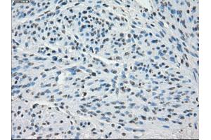 Image no. 2 for anti-Synovial Sarcoma, X Breakpoint 2 (SSX2) antibody (ABIN1501162) (SSX2 抗体)