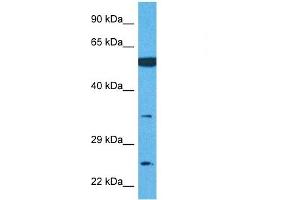 Host:  Rabbit  Target Name:  TMEM158  Sample Tissue:  Human U937 Whole Cell  Antibody Dilution:  1ug/ml
