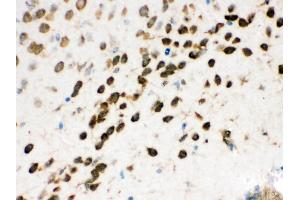 Immunohistochemistry (Paraffin-embedded Sections) (IHC (p)) image for anti-Non-POU Domain Containing, Octamer-Binding (NONO) (AA 1-35), (N-Term) antibody (ABIN3044530)