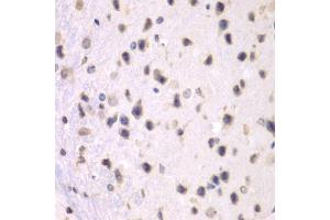 Immunohistochemistry of paraffin-embedded mouse brain using PRMT5 antibody (ABIN5970714) at dilution of 1/100 (40x lens). (PRMT5 抗体)