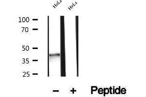 Western blot analysis of extracts of HeLa cells, using NSDHL antibody. (NSDHL 抗体  (Internal Region))