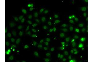 Immunofluorescence analysis of MCF7 cell using NGFRAP1 antibody. (Nerve Growth Factor Receptor (TNFRSF16) Associated Protein 1 (NGFRAP1) 抗体)