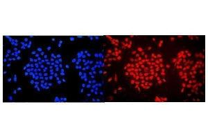 IF analysis of WAC using anti-WAC antibody (ABIN7601789). (WAC 抗体  (AA 459-647))