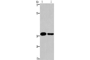 Western Blotting (WB) image for anti-SNAIL (SNAI1) antibody (ABIN2428726) (SNAIL 抗体)