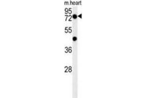 Western blot analysis in mouse heart tissue lysates (15ug/lane) using PHTF2 Antibody . (PHTF2 抗体  (Middle Region))