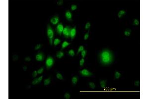 Immunofluorescence of monoclonal antibody to SP1 on HeLa cell. (SP1 抗体  (AA 89-198))