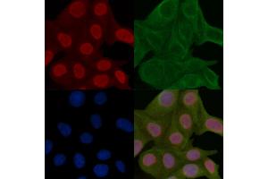 HER2/ErbB2 Mouse Monoclonal Antibody staining Hela cells by IF/ICC.