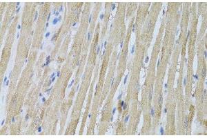 Immunohistochemistry of paraffin-embedded Rat heart using P2RY2 Polyclonal Antibody at dilution of 1:100 (40x lens). (P2RY2 抗体)