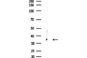 Western blot analysis of lysates from LoVo cells(heat-shock,45 min treatment), using ERLIN1 Antibody at 1/1000 dilution.
