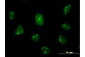 Immunofluorescence of purified MaxPab antibody to C1D on HeLa cell. (C1D 抗体  (AA 1-141))