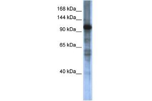 WB Suggested Anti-SMARCAL1 Antibody Titration:  0. (SMARCAL1 抗体  (Middle Region))