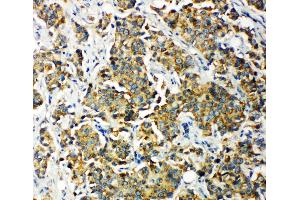 Immunohistochemistry (IHC) image for anti-Pyruvate Dehydrogenase Kinase, Isozyme 2 (PDK2) (AA 379-392), (C-Term) antibody (ABIN3044044)