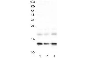 Western blot testing of 1) rat liver, 2) rat RH35 and 3) mouse liver lysate with FABP1 antibody at 0. (FABP1 (liver) 抗体)