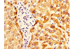 IHC image of ABIN7162288 diluted at 1:400 and staining in paraffin-embedded human liver tissue performed on a Leica BondTM system. (OTC 抗体  (AA 33-354))