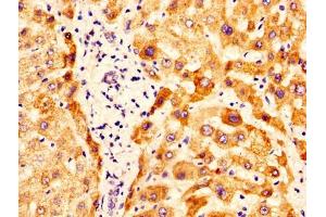 IHC image of ABIN7162288 diluted at 1:400 and staining in paraffin-embedded human liver tissue performed on a Leica BondTM system. (OTC 抗体  (AA 33-354))