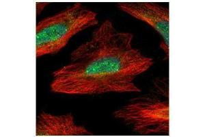 ICC/IF Image Confocal immunofluorescence analysis (Olympus FV10i) of paraformaldehyde-fixed HeLa, using MID1IP1, antibody (Green) at 1:500 dilution. (m1ip1 抗体)
