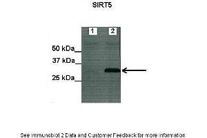 Lanes:   Lane1: Untransfected HEK293T lysate Lane2: mSIRT5-FLAG transfected HEK293T lysate  Primary Antibody Dilution:   1:200  Secondary Antibody:   ProteinA-HRP  Secondary Antibody Dilution:   1:5000  Gene Name:   SIRT5  Submitted by:   Anonymous  There is BioGPS gene expression data showing that SIRT5 is expressed in HEK293T (SIRT5 抗体  (C-Term))