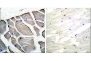 Immunohistochemistry analysis of paraffin-embedded human skeletal muscle tissue, using Actin-pan Antibody. (Actin 抗体  (AA 326-375))