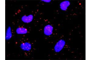 Proximity Ligation Analysis of protein-protein interactions between HIP1 and CLTC. (Clathrin Heavy Chain (CLTC) (AA 232-340) 抗体)