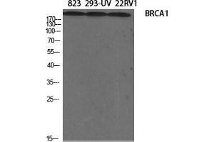 Western Blot (WB) analysis of specific cells using BRCA1 Polyclonal Antibody. (BRCA1 抗体  (Ser184))