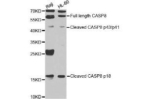 Western blot analysis of extracts of Raji cell and HL-60 cell line, using CASP8 antibody. (Caspase 8 抗体)