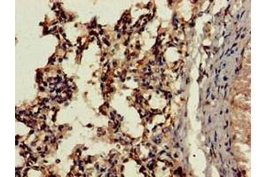 Immunohistochemistry of paraffin-embedded human lung tissue using ABIN7164288 at dilution of 1:100 (Cathepsin H 抗体  (AA 116-219))