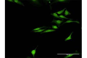 Immunofluorescence of purified MaxPab antibody to SNCG on HeLa cell. (SNCG 抗体  (AA 1-127))