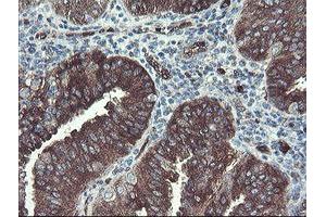 Image no. 5 for anti-TSC22 Domain Family, Member 1 (TSC22D1) antibody (ABIN1501540)