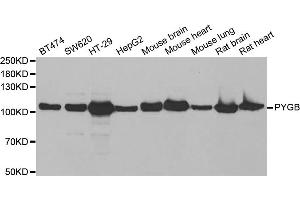 Western blot analysis of extracts of various cell lines, using PYGB antibody (ABIN5973803) at 1/1000 dilution. (PYGB 抗体)