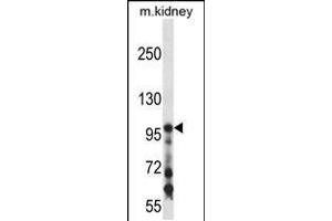 Western blot analysis in mouse kidney tissue lysates (35ug/lane). (COL1A1 抗体  (C-Term))