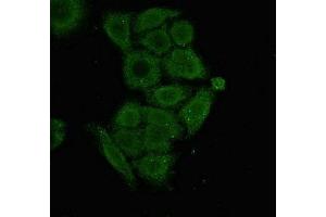 Immunofluorescent analysis of PC-3 cells using ABIN7166156 at dilution of 1:100 and Alexa Fluor 488-congugated AffiniPure Goat Anti-Rabbit IgG(H+L) (SSX1 抗体  (AA 112-188))