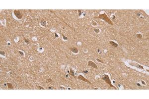 Immunohistochemistry of paraffin-embedded Human brain tissue using RAB6C Polyclonal Antibody at dilution 1:45 (WTH3DI 抗体)