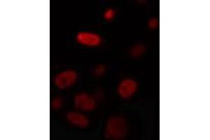 ABIN6274327 staining HuvEc cells by IF/ICC. (Nuclear Factor 1 抗体)
