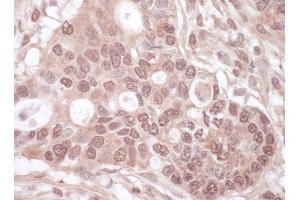 Immunohistochemistry (IHC) image for anti-THO Complex 1 (THOC1) (AA 550-600) antibody (ABIN7454471)