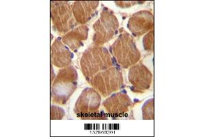 ASAM Antibody immunohistochemistry analysis in formalin fixed and paraffin embedded human skeletal muscle followed by peroxidase conjugation of the secondary antibody and DAB staining. (CLMP 抗体  (AA 81-110))