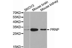 Western blot analysis of extracts of various cell lines, using PRNP antibody (ABIN5971407) at 1/1000 dilution. (PRNP 抗体)