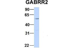 Host:  Rabbit  Target Name:  GABRR2  Sample Type:  293T  Antibody Dilution:  1. (GABRR2 抗体  (Middle Region))