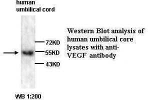 Western Blotting (WB) image for anti-Vascular Endothelial Growth Factor A (VEGFA) antibody (ABIN6583751) (VEGFA 抗体)