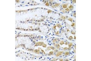 Immunohistochemistry of paraffin-embedded human stomach using TRMT1 antibody. (TRMT1 抗体  (AA 460-659))