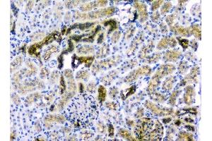 IHC analysis of CD2AP using anti-CD2AP antibody (ABIN6719544).