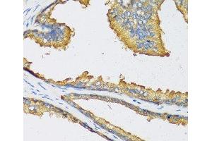 Immunohistochemistry of paraffin-embedded Human prostate using CXCL11 Polyclonal Antibody at dilution of 1:100 (40x lens). (CXCL11 抗体)